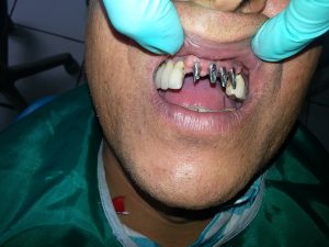 Centro Dental El Alba