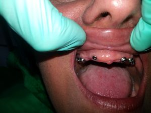 Centro Dental El Alba