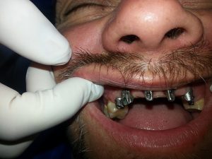 Centro Dental El Alba