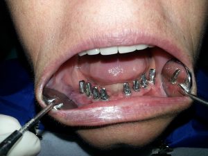 Centro Dental El Alba