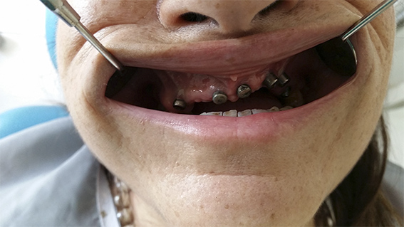 Centro Dental El Alba